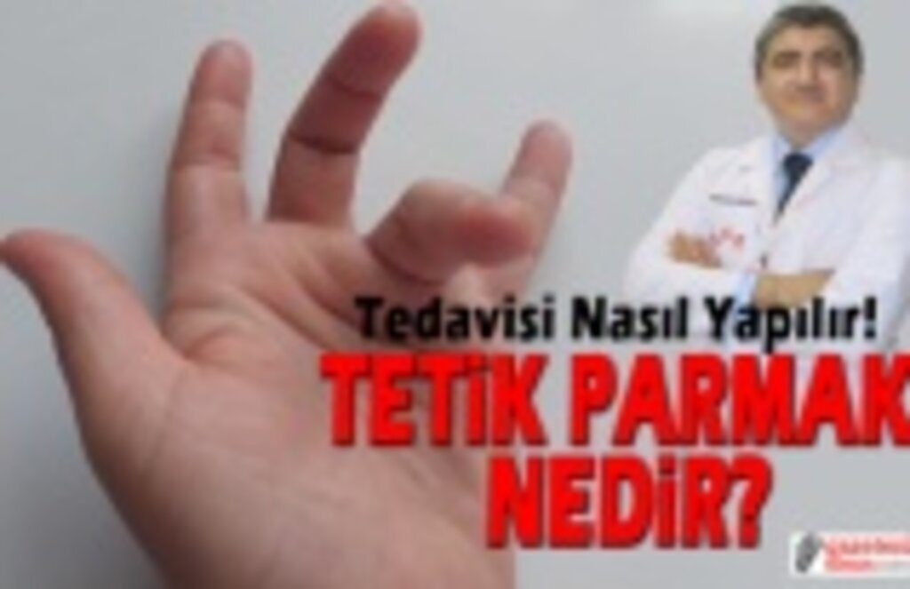Tetik Parmak Nedir, Tedavisi Nasıl Yapılır!
