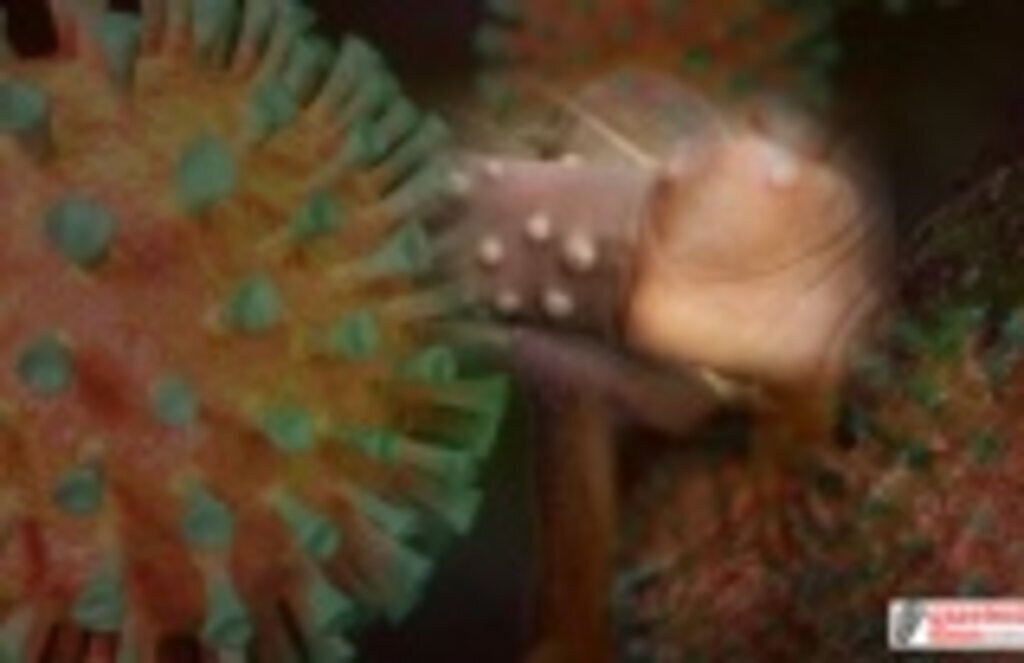 Maymun çiçeği virüsü nasıl bulaşır? Maymun çiçeği belirtileri nelerdir?