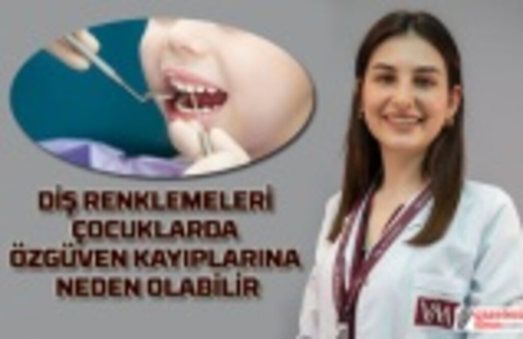 Çocuklarda diş renklenmeleri zararlı mı?