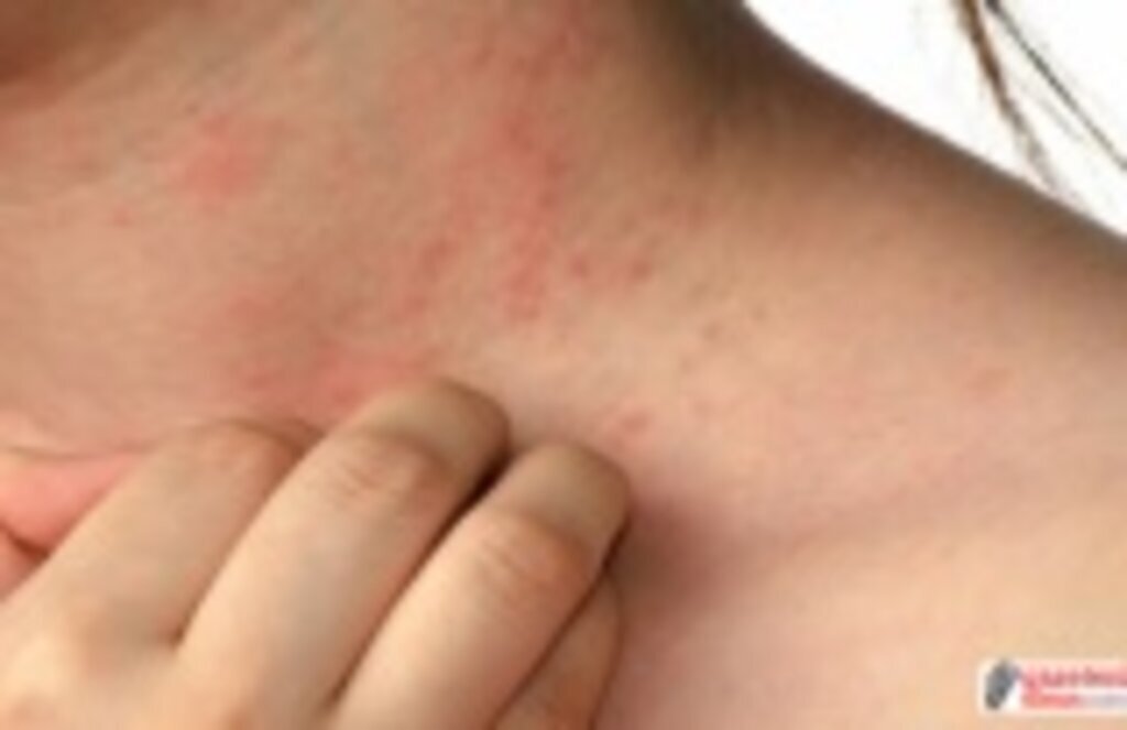 Akşam saatlerinde yoğunlaşan kaşıntıya dikkat! Uyuz muyum?