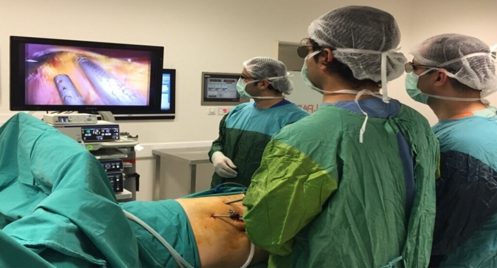 3 Boyutlu Laparoskopi tıpta teknolojinin son noktası