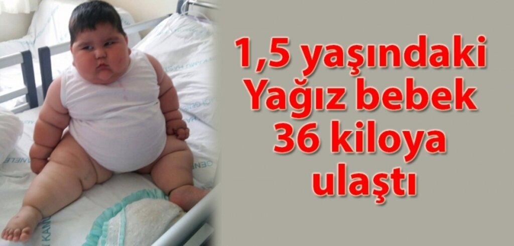 36 kiloya ulaşan Yağız bebek yardım bekliyor