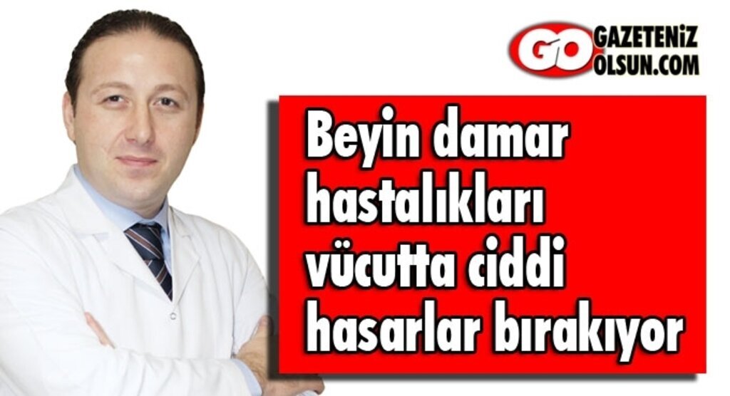 Büyük Anadolu Hastanesi'nden 'Beyin damar hastalıkları' uyarısı