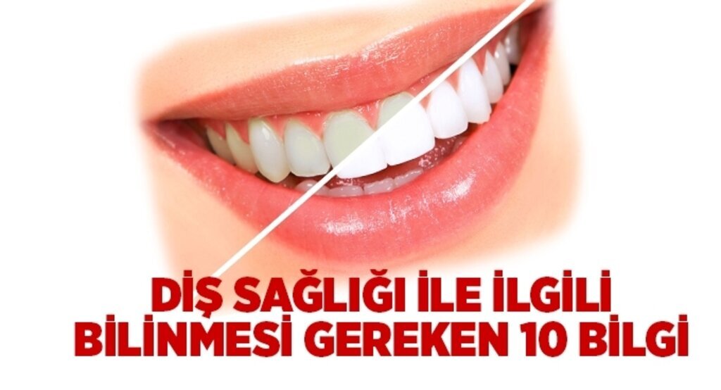 Diş sağlığı ile ilgili bilinmesi gereken 10 bilgi
