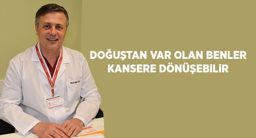 Doğuştan var olan benler kansere dönüşebilir