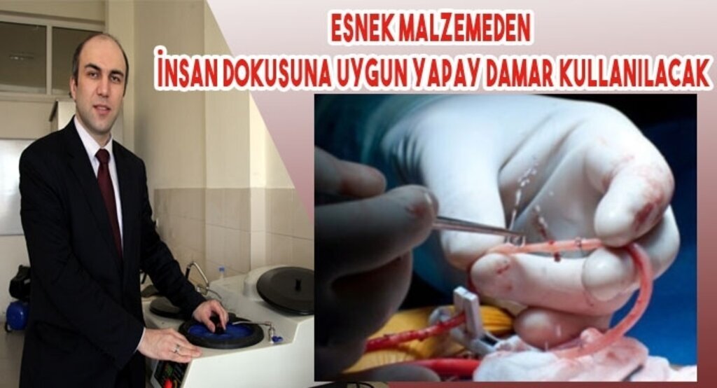 Esnek malzemeden insan dokusuna uygun 'yapay damar'