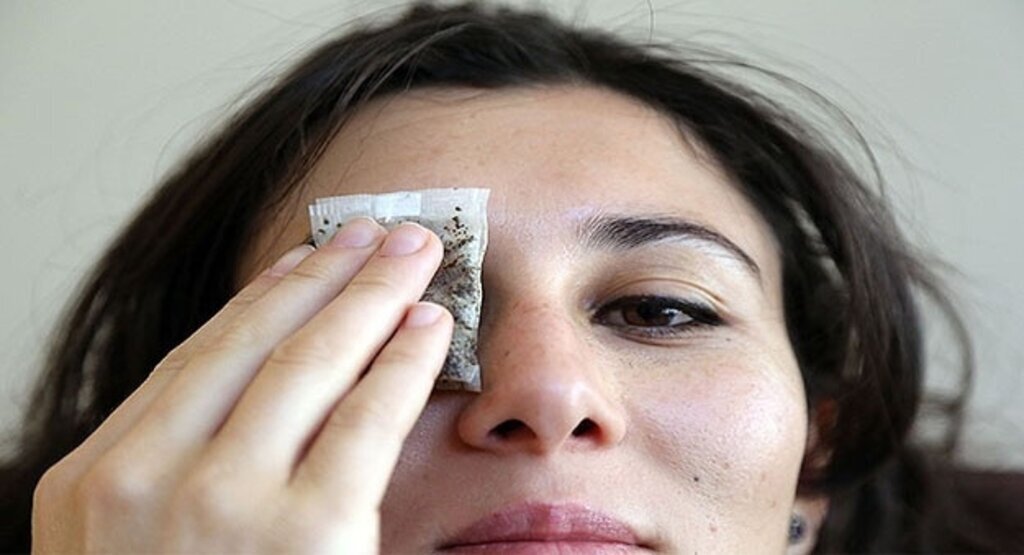 Göz pansumanı için 'şekersiz çay'