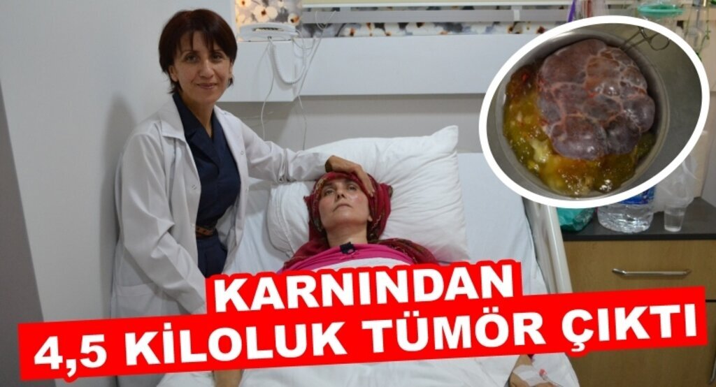 Karnından 4,5 kiloluk tümör çıktı