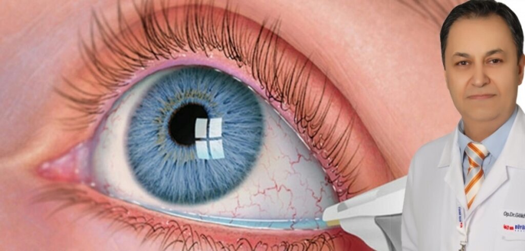 Kurugöz hastalığı körlüğe neden oluyor