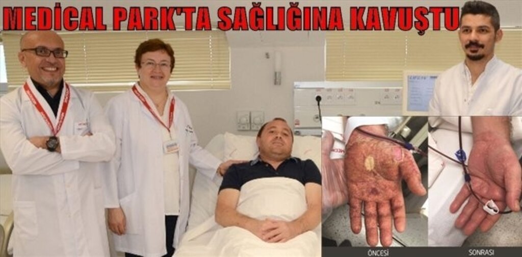 Romatizmal Hasta Aferez Tekniği Sayesinde Sağlığına Kavuştu