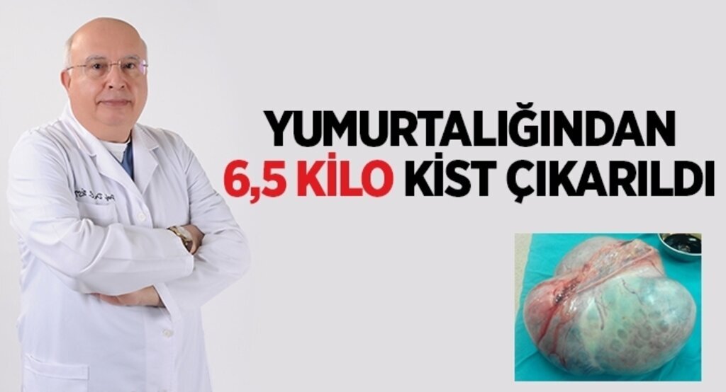Yumurtalığından 6,5 kilo kist çıkarıldı